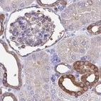 Immunohistochemical staining of human kidney using Anti-TPD52 antibody HPA062167.