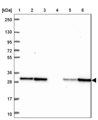 Lane 1: Marker [kDa] 250, 130, 95, 72, 55, 36, 28, 17, 10_br/_Lane 2: Human cell line RT-4_br/_Lane 3: Human cell line U-251 MG_br/_Lane 4: Human plasma_br/_Lane 5: Human Liver tissue_br/_Lane 6: Human Tonsil tissue
