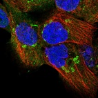 Anti-TPD52 Antibody