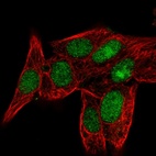 Anti-PPIL3 Antibody