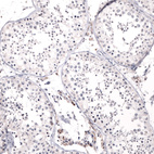 Immunohistochemical staining of human testis shows no positivity in cells in seminiferous ducts.