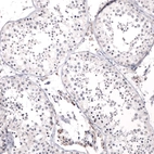 Immunohistochemical staining of human testis shows no positivity in cells in seminiferous ducts.