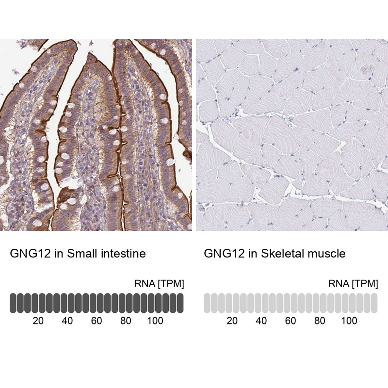 Anti-GNG12 Antibody
