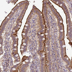 Immunohistochemical staining of human small intestine shows strong membranous positivity in glandular cells.