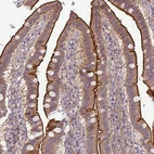 Immunohistochemical staining of human small intestine shows strong membranous positivity in glandular cells.