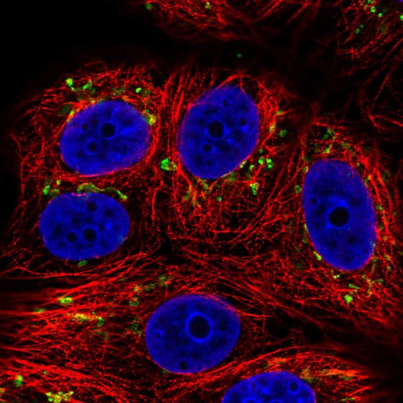Anti-SLC35E1 Antibody