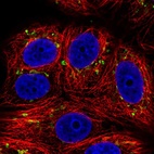 Anti-SLC35E1 Antibody