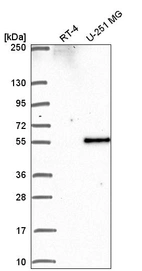 Anti-PIP4K2B Antibody