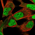 Immunofluorescent staining of human cell line RH-30 shows localization to nucleoplasm.