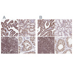 Anti-XRCC6 Antibody