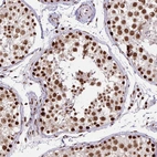Immunohistochemical staining of human testis shows strong nuclear positivity in cells in seminiferous ducts.
