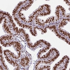 Immunohistochemical staining of human fallopian tube shows strong nuclear positivity in glandular cells.