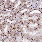 Anti-XRCC6 Antibody