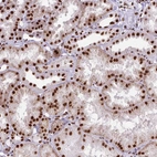 Immunohistochemical staining of human kidney shows strong nuclear positivity in cells in tubules.