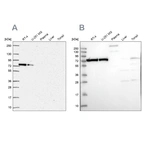 Western blot analysis using Anti-XRCC6 antibody HPA062226 (A) shows similar pattern to independent antibody HPA047549 (B).
