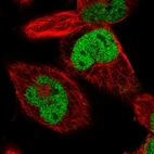 Immunofluorescent staining of human cell line RH-30 shows localization to nucleoplasm.