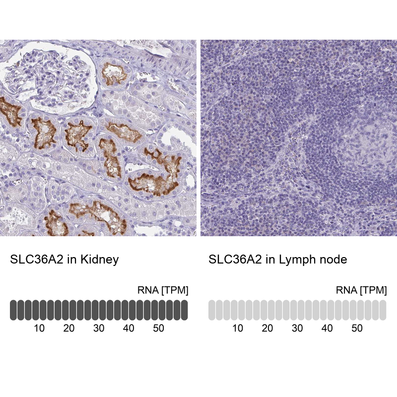 Anti-SLC36A2 Antibody