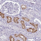 Anti-SLC36A2 Antibody