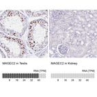 Anti-MAGEC2 Antibody