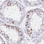 Immunohistochemical staining of human testis shows strong nuclear positivity in a subset of cells in seminiferous ducts.
