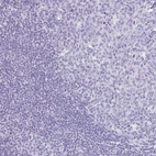 Immunohistochemical staining of human tonsil shows no positivity as expected.