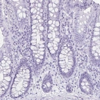 Immunohistochemical staining of human colon shows no positivity in glandular cells as expected.