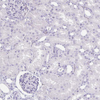Immunohistochemical staining of human kidney shows no positivity as expected.