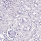 Immunohistochemical staining of human kidney shows no positivity as expected.