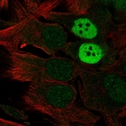 Immunofluorescent staining of human cell line SK-MEL-30 shows localization to nucleus & nucleoli.