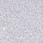 Immunohistochemical staining of human liver shows no positivity in hepatocytes as expected.