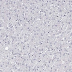 Immunohistochemical staining of human liver shows no positivity in hepatocytes as expected.