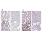 Immunohistochemical staining of human kidney, liver, small intestine and testis using Anti-MISP antibody HPA062232 (A) shows similar protein distribution across tissues to independent antibody HPA049511 (B).
