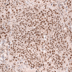 Anti-MSH3 Antibody