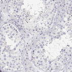 Immunohistochemical staining of human testis shows no positivity in cells in seminiferous ducts as expected.
