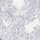 Immunohistochemical staining of human testis shows no positivity in cells in seminiferous ducts as expected.