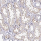 Immunohistochemical staining of human kidney shows moderate positivity in luminal membrane in cells in tubules.