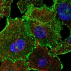Immunofluorescent staining of human cell line A549 shows localization to plasma membrane & focal adhesion sites.