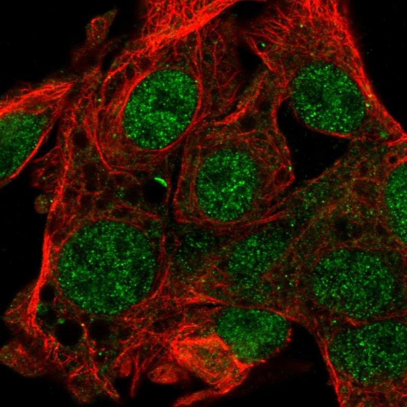 Anti-FAM222B Antibody
