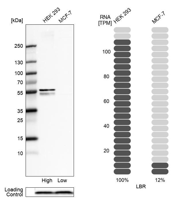 Anti-LBR Antibody