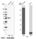 Anti-LBR Antibody