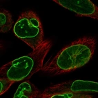 Immunofluorescent staining of human cell line RH-30 shows localization to nuclear membrane.
