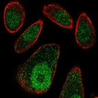 Anti-FBXO27 Antibody