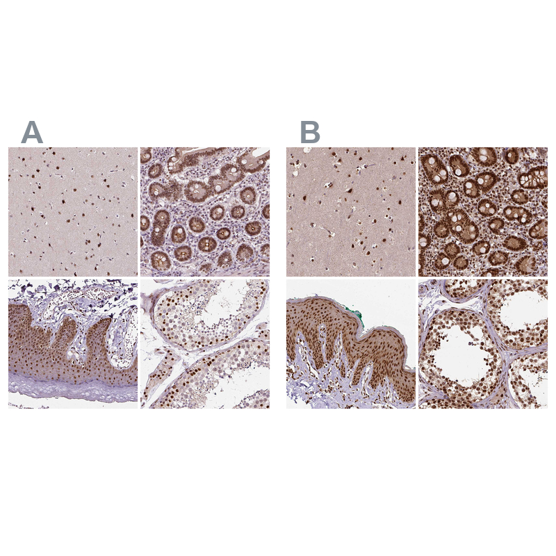 Anti-NACC1 Antibody