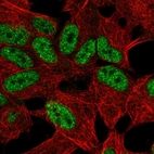 Anti-TLX2 Antibody