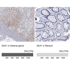 Anti-DLK1 Antibody