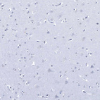 Immunohistochemical staining of human cerebral cortex shows no positivity in neuronal cells as expected.