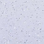 Immunohistochemical staining of human cerebral cortex shows no positivity in neuronal cells as expected.