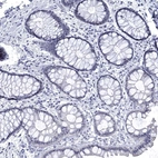 Immunohistochemical staining of human rectum shows no positivity in glandular cells as expected.