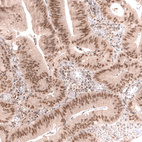 Anti-MSH3 Antibody