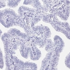 Immunohistochemical staining of human fallopian tube shows no positivity in glandular cells as expected.